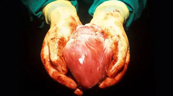 خیلی عجیب / مردی که دو قلب داشت! / آمریکا