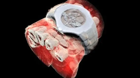 نخستین عکس سه بعدی رنگی اشعه ایکس از بدن انسان منتشر شد