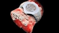 نخستین عکس سه بعدی رنگی اشعه ایکس از بدن انسان منتشر شد