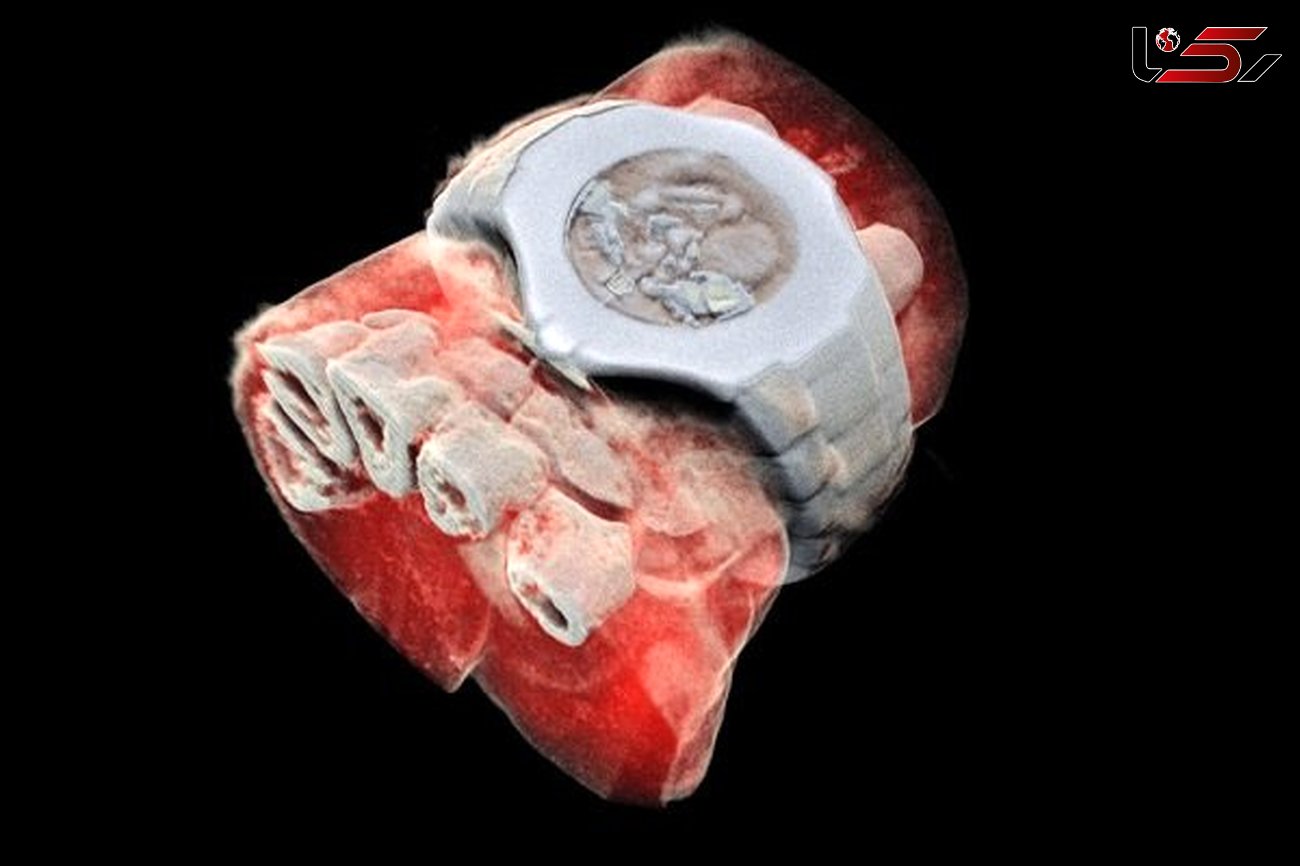 نخستین عکس سه بعدی رنگی اشعه ایکس از بدن انسان منتشر شد