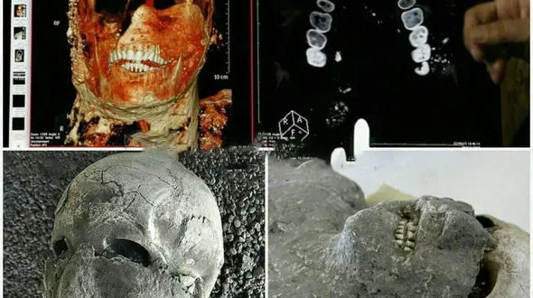 راز سلامت دندان های مردم روم باستان چه بود؟! + عکس های باورنکردنی