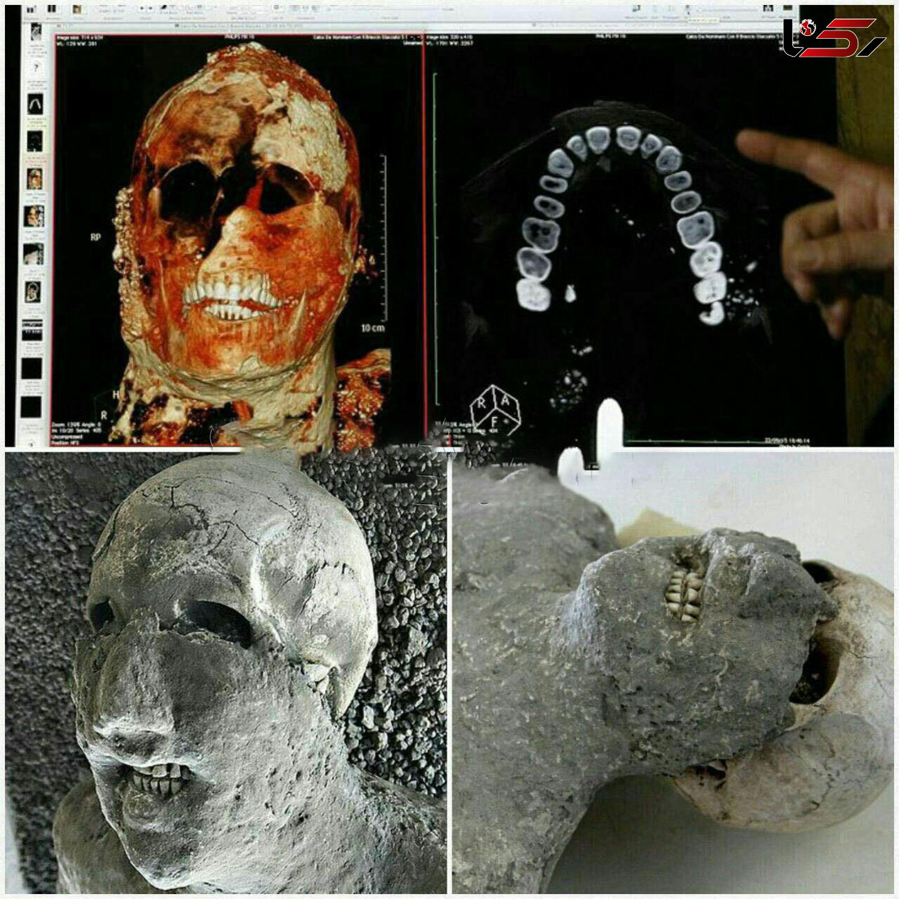 راز سلامت دندان های مردم روم باستان چه بود؟! + عکس های باورنکردنی