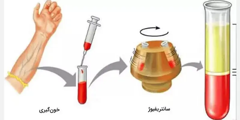 آزمایش هماتوکریت