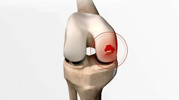 غضروف سازهای طبیعی 