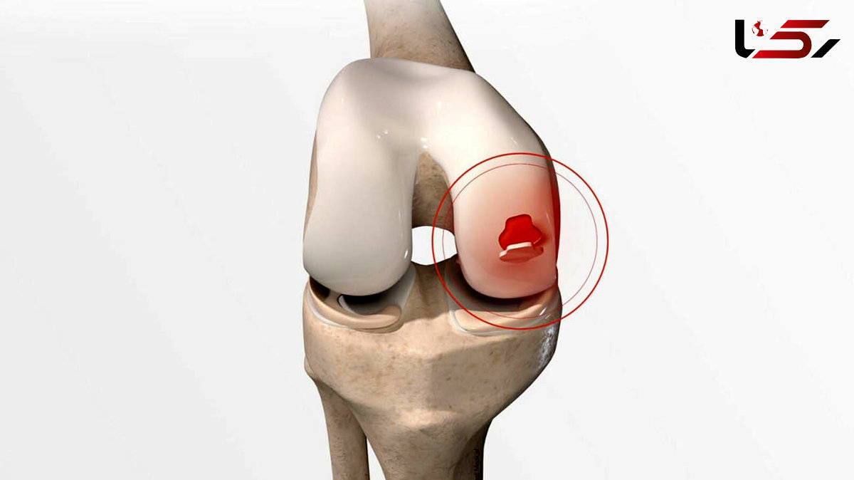 غضروف سازهای طبیعی 