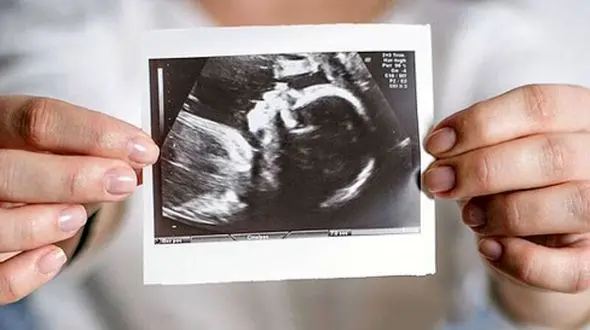 نکات طلایی طب سنتی برای مراقبت از بارداری در تابستان