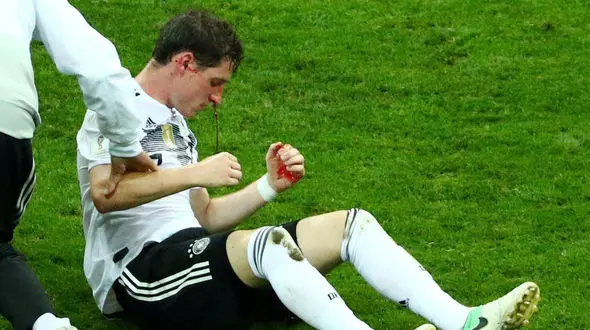 لحظه ترس آور شکسته شدن بینی بازیکن آلمان +عکس