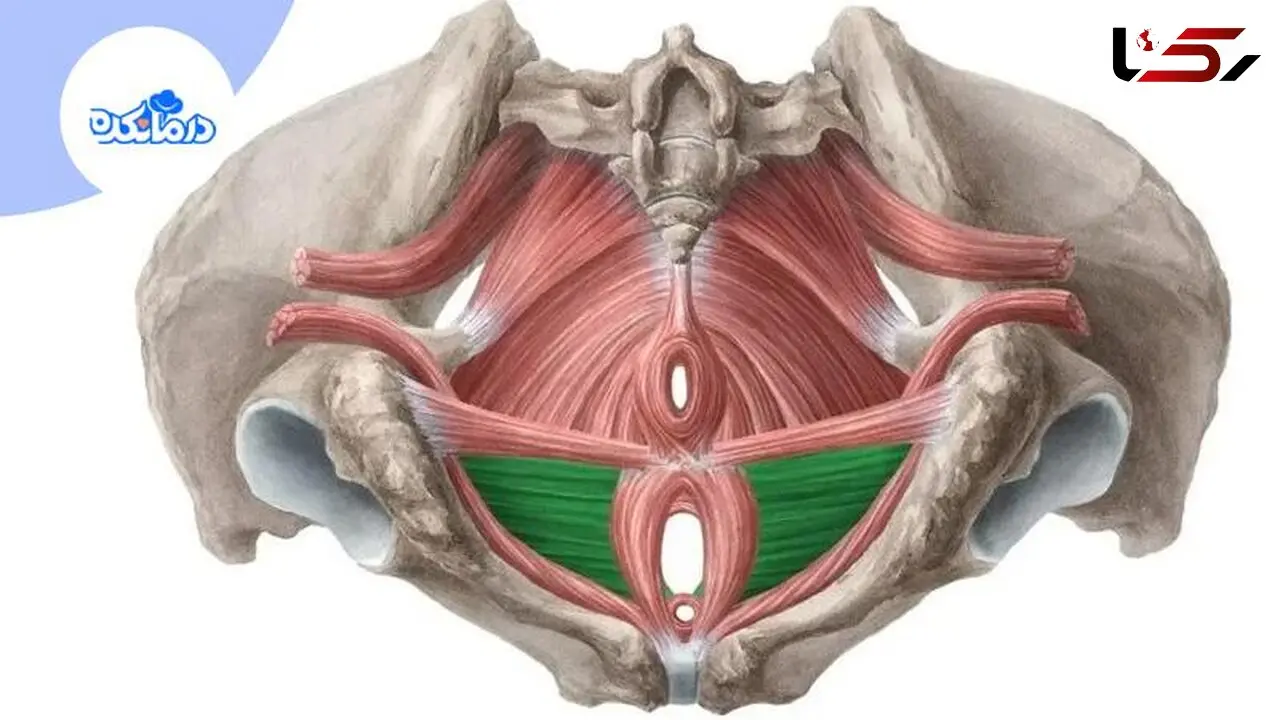 علائم افتادگی مثانه چیست و چگونه درمان می‌شود؟