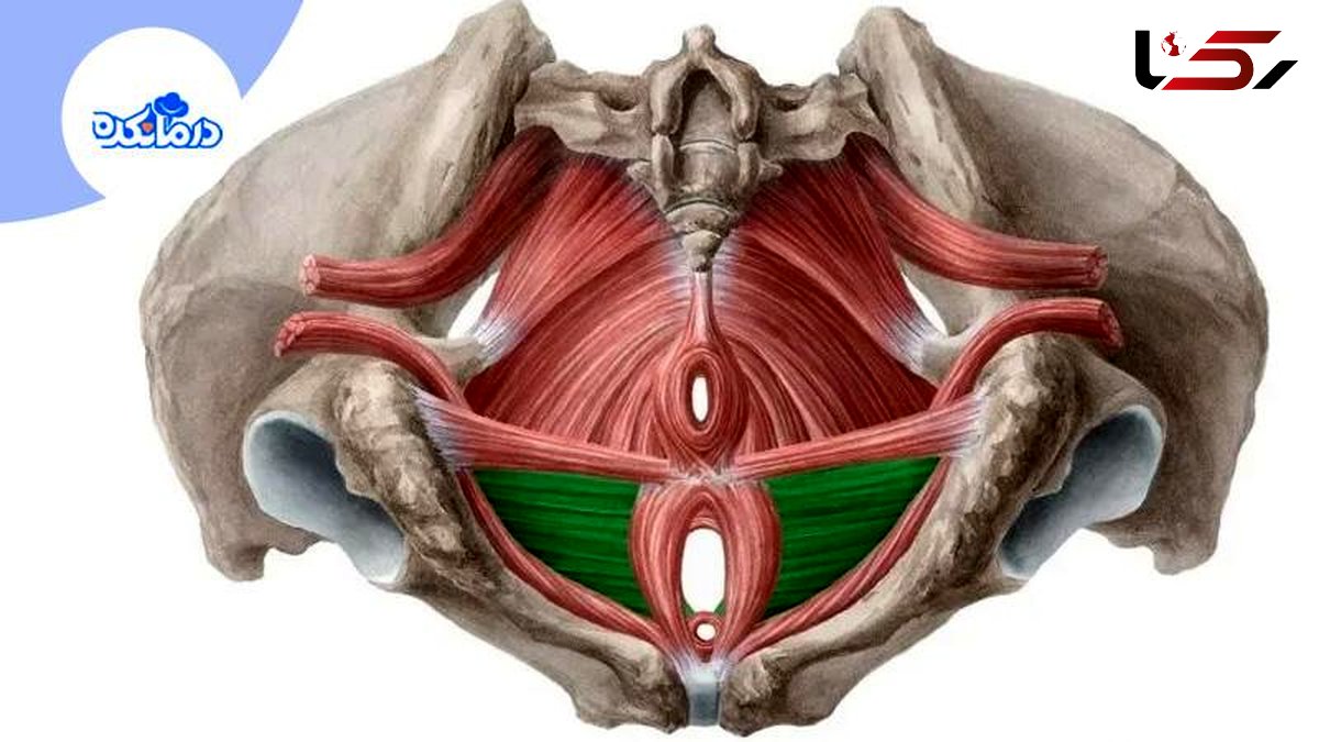 علائم افتادگی مثانه چیست و چگونه درمان می‌شود؟