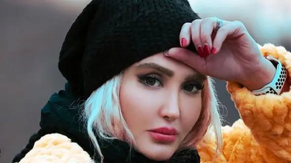 اعتیاد زهره فکورصبور به عمل زیبایی ! / او را نمی شناسید! + عکس اروپایی اش