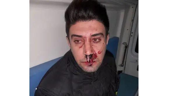 کتک زدن تلخ مامور اورژانس در صحنه خودکشی + عکس صورت خونین و مالین