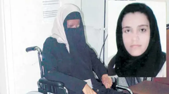 این زن توسط عروس حسود با اسید سوخت! + عکس 