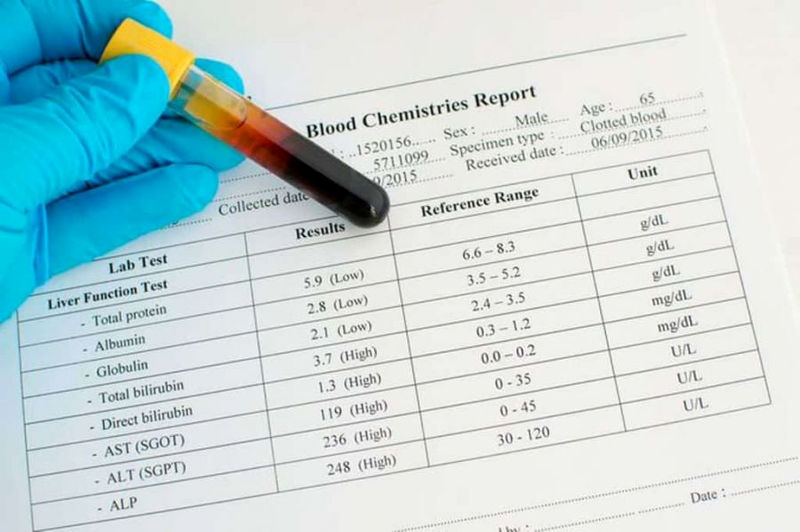 alt در آزمایش خون چیست