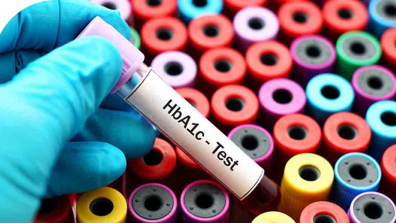 آزمایش HbA1c