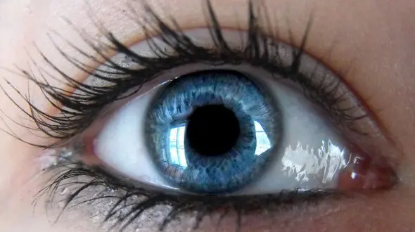 بیماری التهاب عنبیه چیست؟
