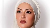 تغییر چهره زیبا بروفه  که زمانی زیباترین خانم بازیگر ایران بود ! + عکس ها قبل و حالا