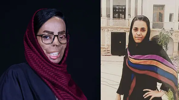 عکس قبل و بعد از اسید سوختگی عروس تهرانی! / فریادهای جانسوز در دادگاه خواهرشوهر اسیدپاش!
