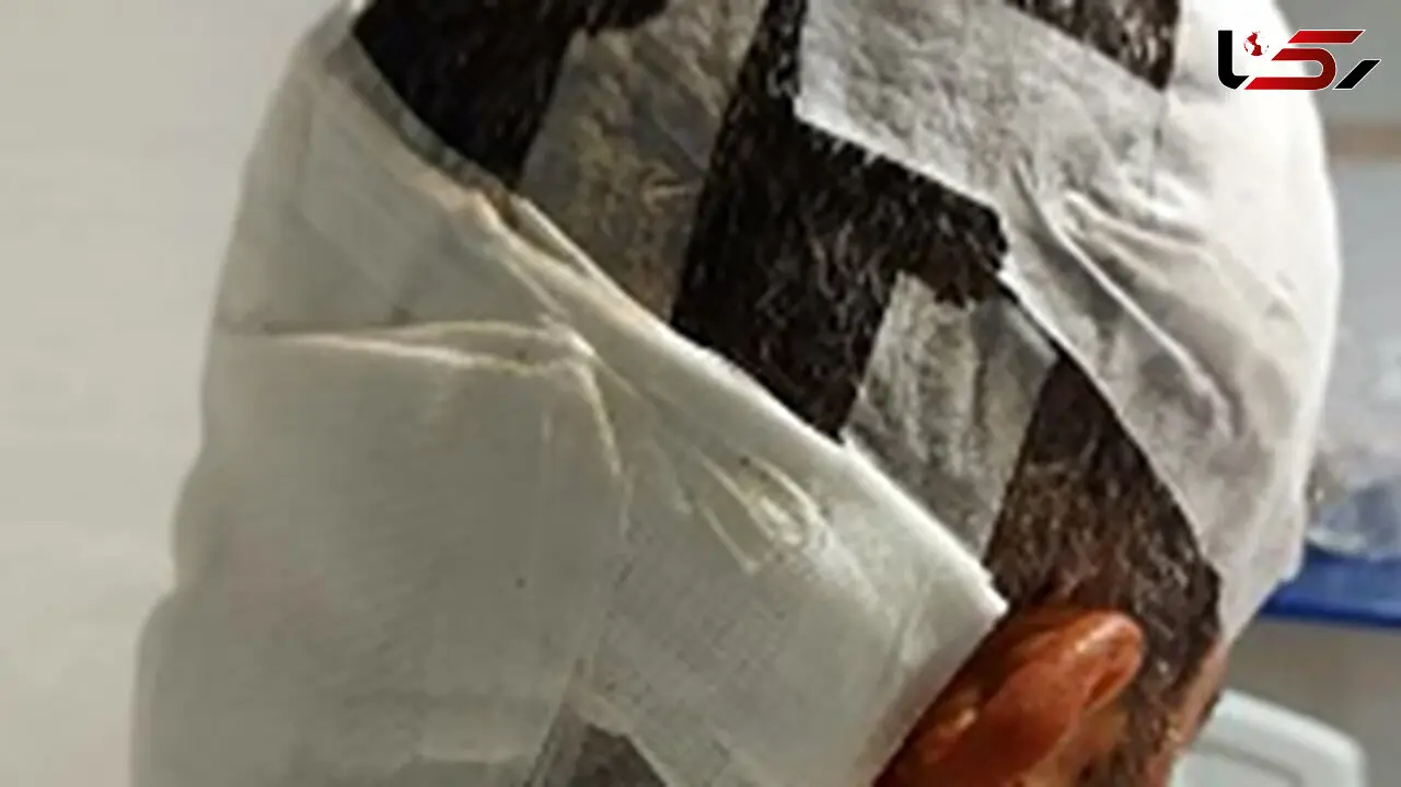 خرس گرسنه مرد سی سختی را درید + عکس صحنه 