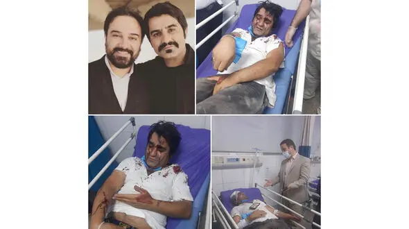 حمله خونین به 2 بازیگر سریال دودکش  + عکس ها