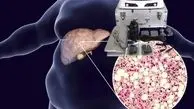 9 نشانه تجمع سموم در بدن تان / روش های سم زدایی بدن