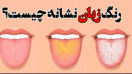 نشانه های بیماری از روی رنگ زبان 