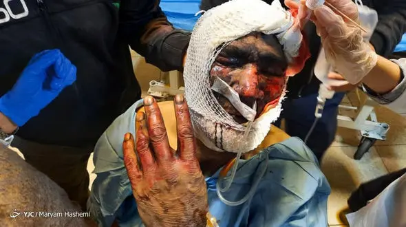 تصاویر تلخ از مصدومان چهارشنبه سوری امسال