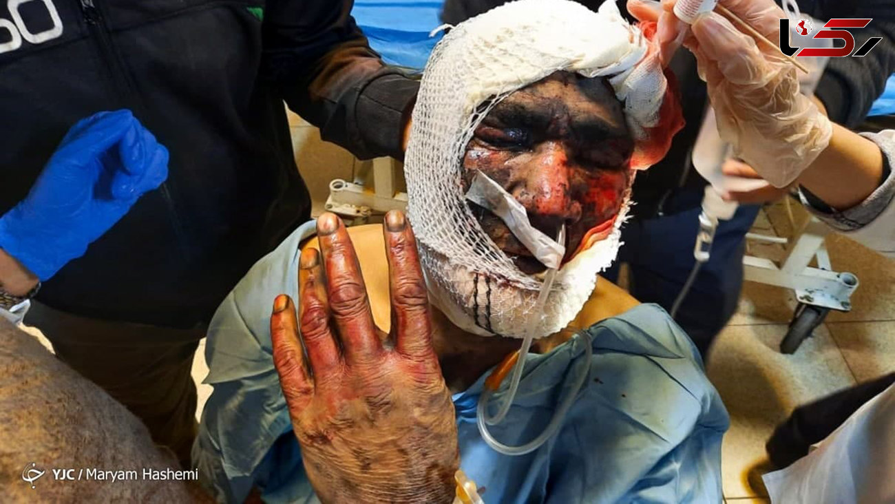 تصاویر تلخ از مصدومان چهارشنبه سوری امسال