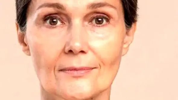 تاثیر نور خورشید بر پیری پوست / چگونه جلوگیری کنیم؟