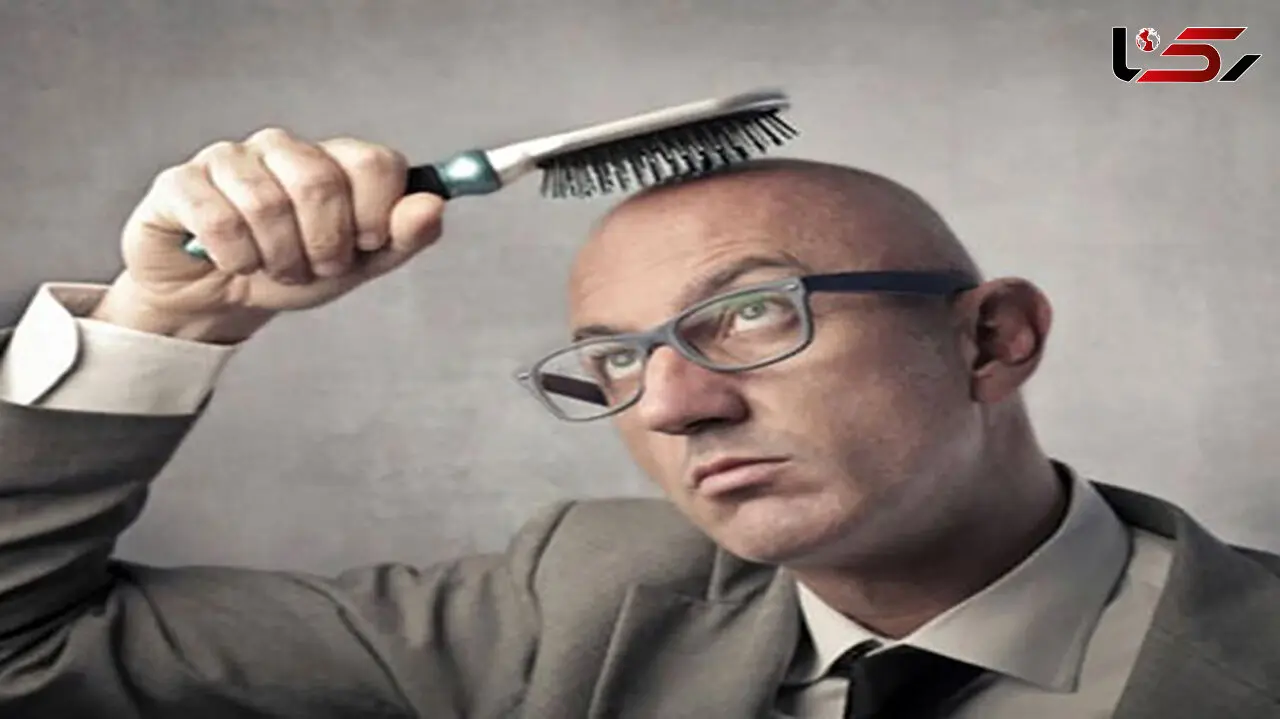 رد پای کرونا در ریزش مو!