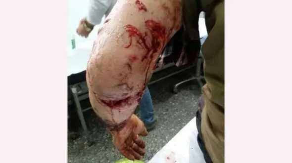 پلنگ  چوپان گیلانی را تیکه پاره کرد / چوپان به کما رفت + عکس 
