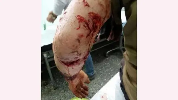 پلنگ  چوپان گیلانی را تیکه پاره کرد / چوپان به کما رفت + عکس 