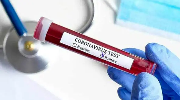 یک کرونایی به عمد دیگران را بیمار می کرد / او کشته شد / ژاپن