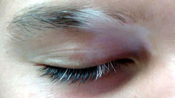 داروهای خانگی و نکاتی برای رفع ابروهای سفید