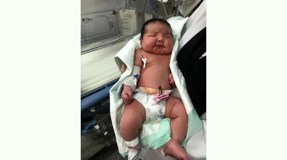 تولد نوزاد 6 کیلویی در تهران+ عکس