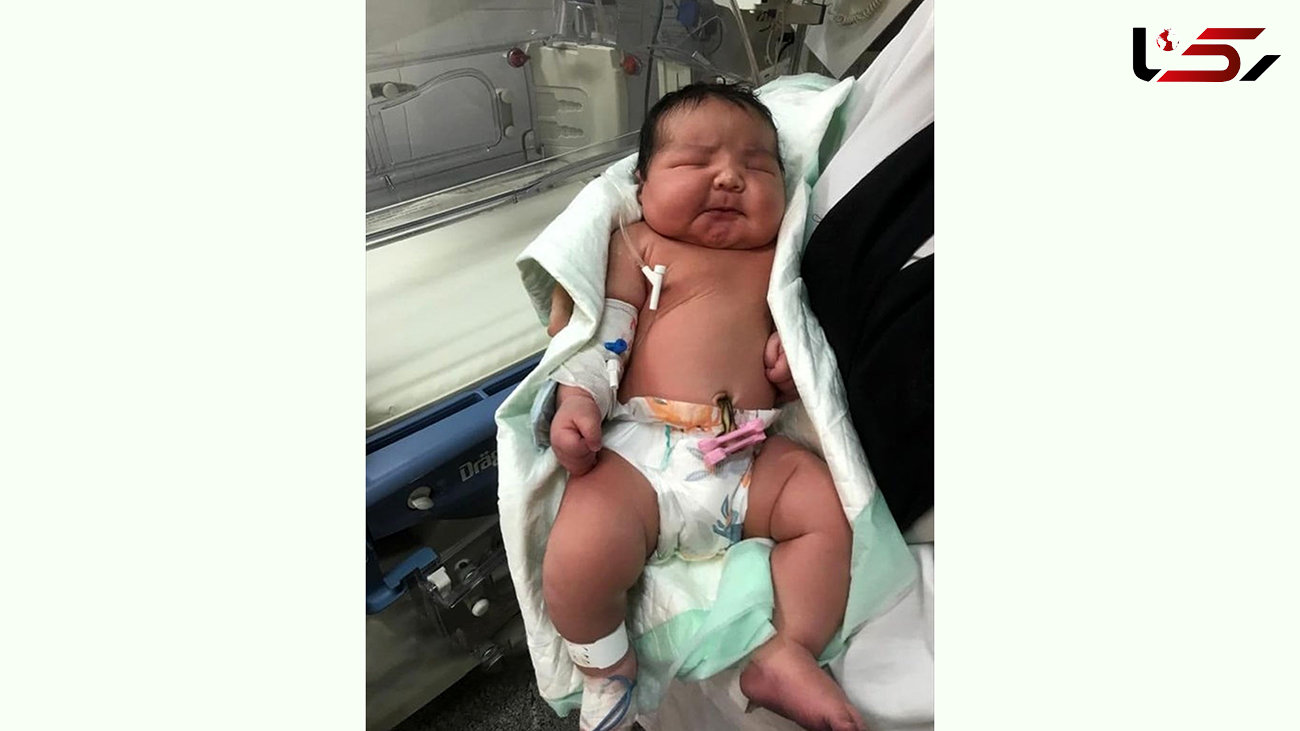 تولد نوزاد 6 کیلویی در تهران+ عکس