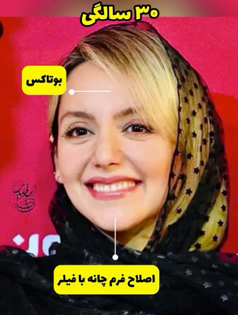 سیر تغییر چهره نازنین بیاتی