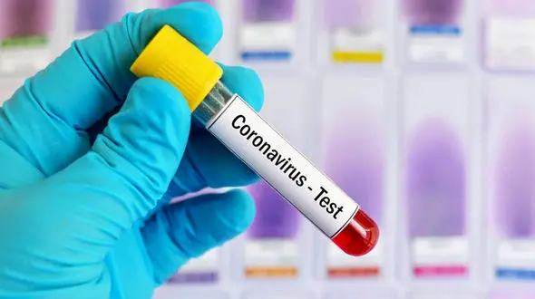 قیمت آزمایش کرونا در ایران + فیلم