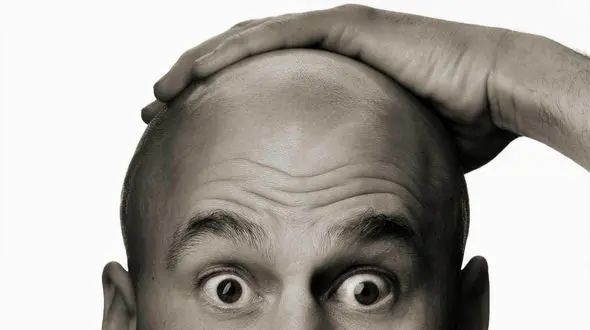 درمان کچلی با دستگاه پوشیدنی میکرولیزر