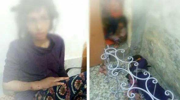  کودکان شکنجه شده  ماهشهری صاحب سرپرست مهربان شدند + عکس