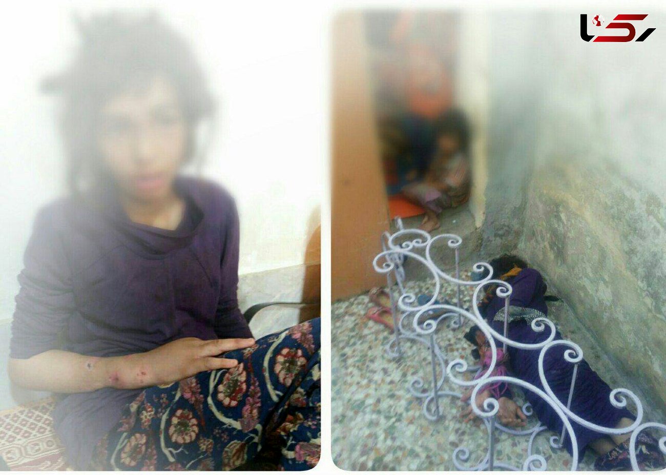 کودکان شکنجه شده  ماهشهری صاحب سرپرست مهربان شدند + عکس