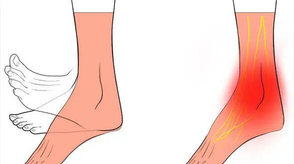 درمان خاص ضرب دیدگی هر عضو بدن 