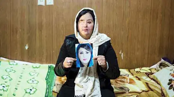 آخرین گفتگو با سهیلا جورکش/ بینایی چشم چپم را با روش جراحی نوین به دست آوردم + عکس