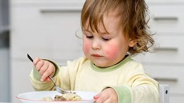 درمان مناسب حساسیت های غذایی کودکان