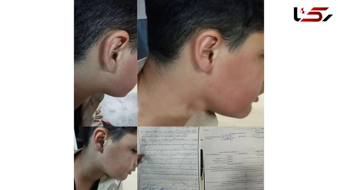لغو ابلاغ معلم خاطی در پی تنبیه بدنی دانش  آموز لاهیجانی