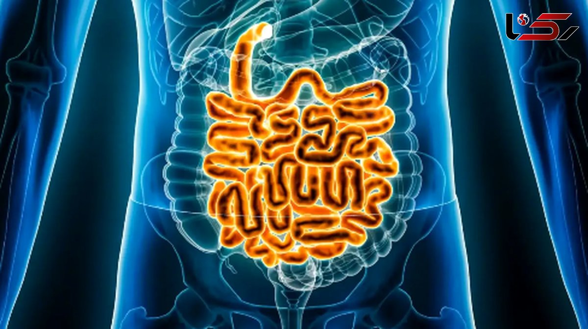 تغذیه تکراری؛ قاتل خاموش سیستم گوارشی شما؟