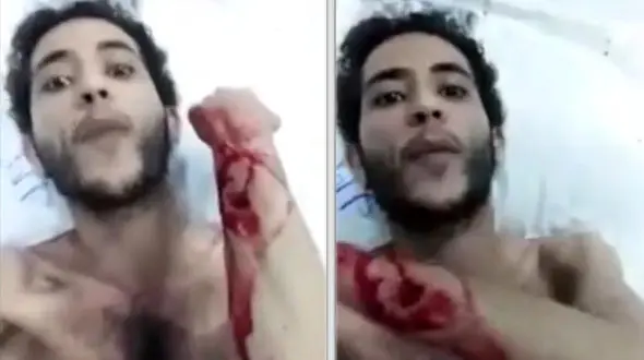 اقدام زشت با بیمار یمنی در بیمارستان دولتی سعودی + فیلم و عکس