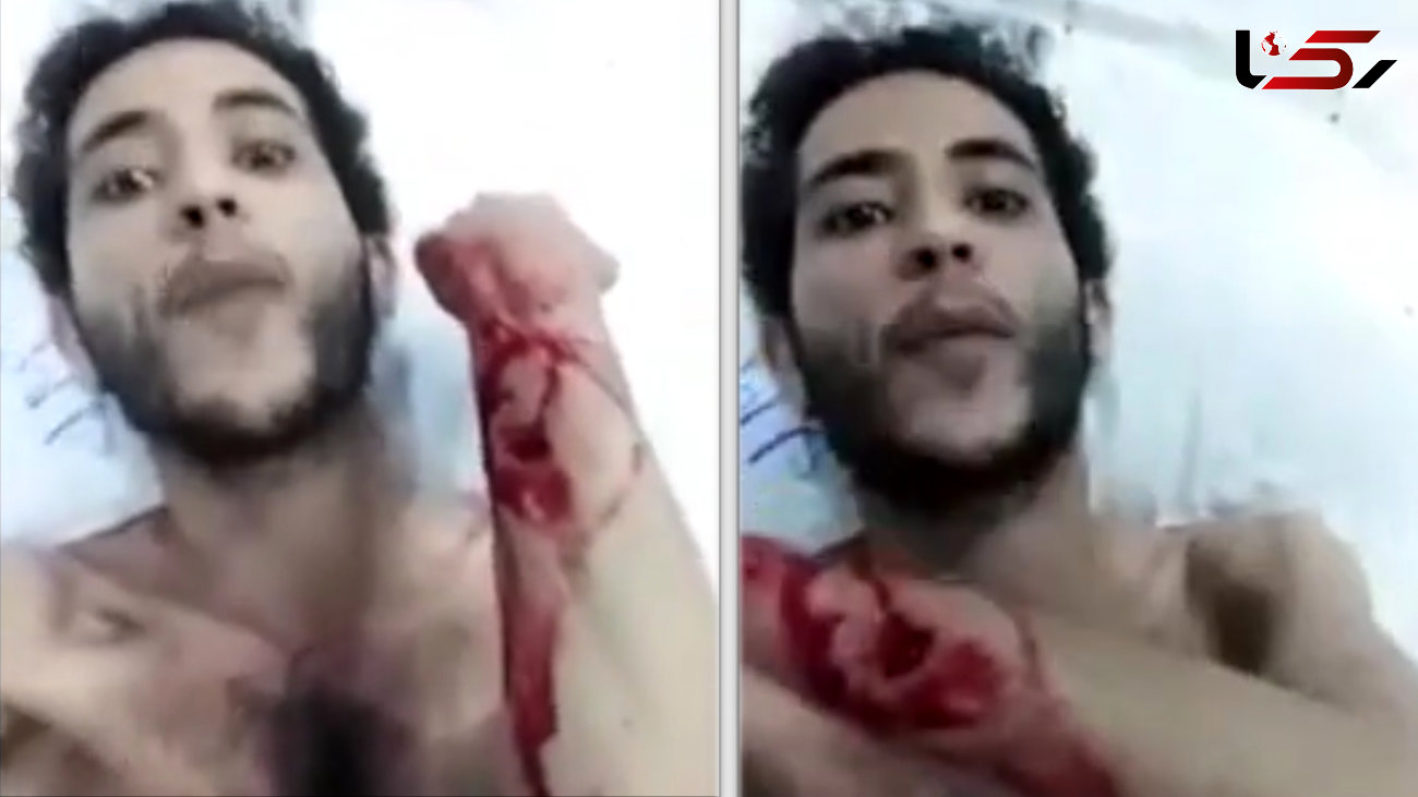 اقدام زشت با بیمار یمنی در بیمارستان دولتی سعودی + فیلم و عکس