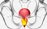 علت بزرگ شدن پروستات چیست؟ / نقش تغذیه در بزرگ شدن پروستات