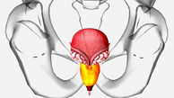 علت بزرگ شدن پروستات چیست؟ / نقش تغذیه در بزرگ شدن پروستات