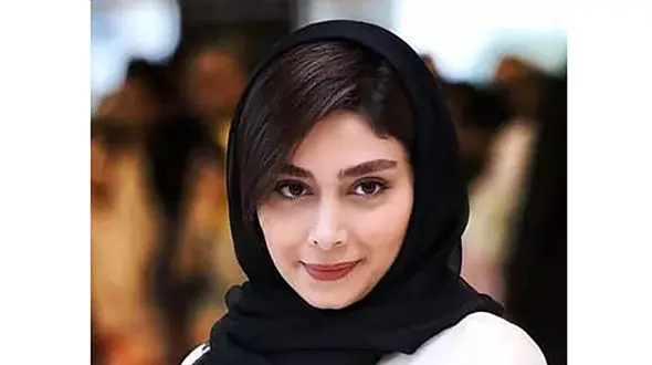 خانم بازیگری که 2 رنگ چشم دارد! / هر چشم یک رنگ!